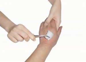 創傷とは 治癒過程に応じた適切な看護について
